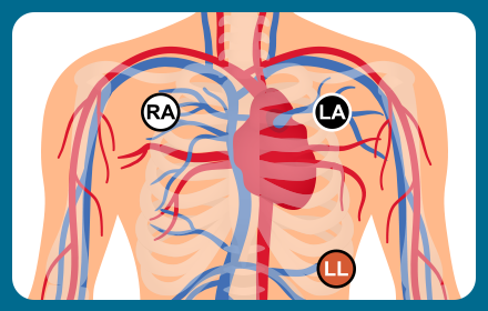 ECG 3 Lead Tests