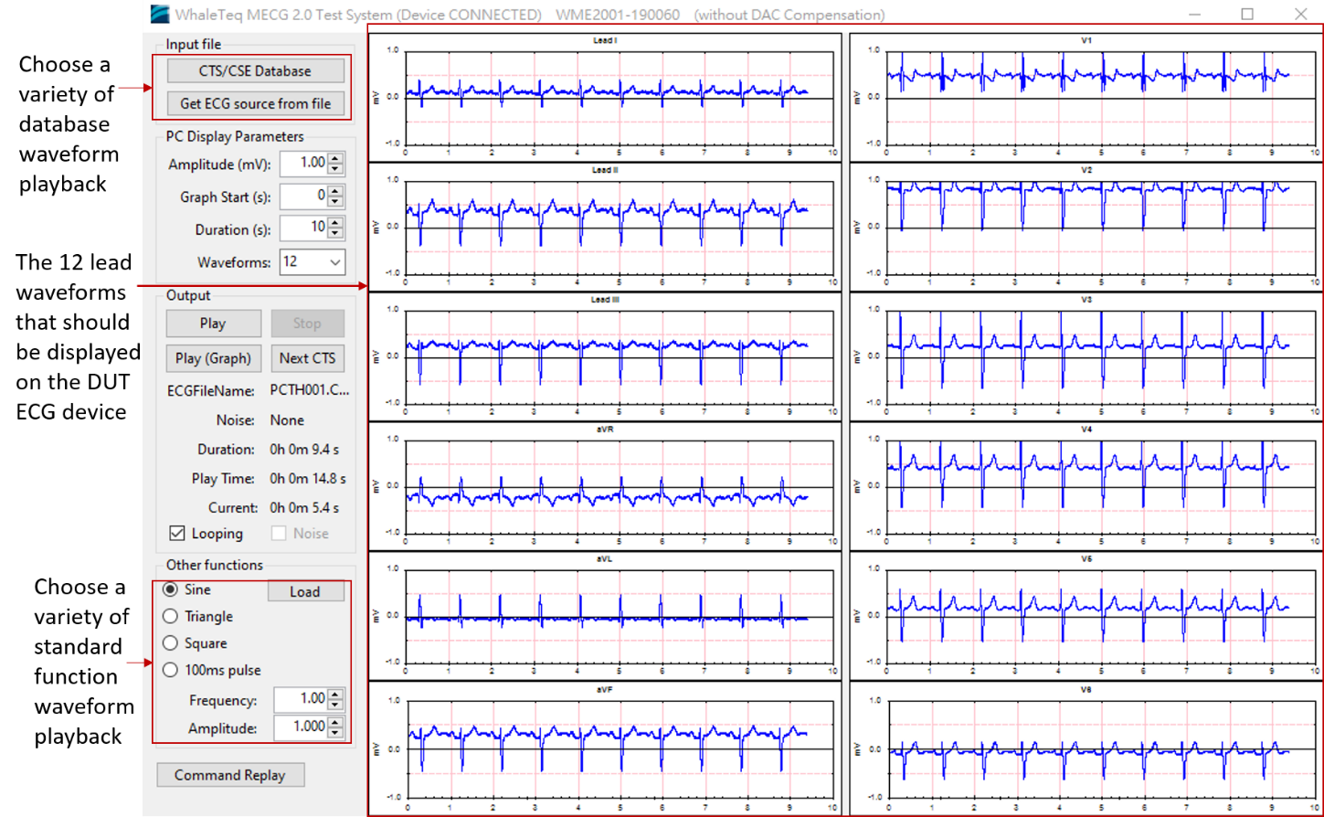 MECG 2.0 software and 12 leads waveforms display MECG 2.0 software and 12 leads waveforms display