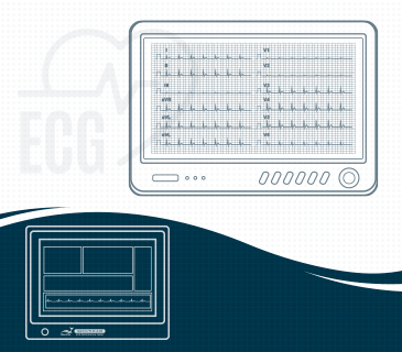 ECG / EKG Testing